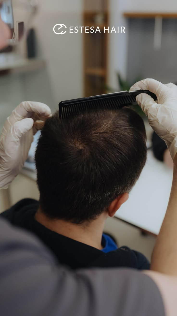 After hair transplant
